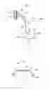 Fig. 03 - Implantable device for external urinary control