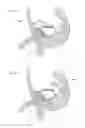 Fig. 04 - Implantable device for external urinary control