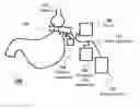 Fig. 01 - Apparatus and methods for corrective guidance of eating behavior after weight loss surgery