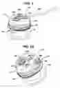 Fig. 02 - METHODS AND DEVICES FOR PROVIDING ACCESS INTO A BODY CAVITY