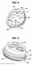 Fig. 06 - METHODS AND DEVICES FOR PROVIDING ACCESS INTO A BODY CAVITY