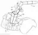 Fig. 01 - SURGICAL RETRACTOR