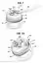 Fig. 02 - METHODS AND DEVICES FOR PROVIDING ACCESS INTO A BODY CAVITY