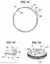 Fig. 09 - METHODS AND DEVICES FOR PROVIDING ACCESS INTO A BODY CAVITY