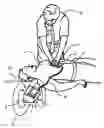 Fig. 01 - System and method for determining depth of chest compressions