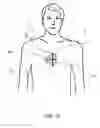 Fig. 32 - System and method for determining depth of chest compressions