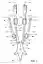 Fig. 02 - Catheter flushing assembly