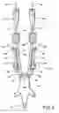 Fig. 03 - Catheter flushing assembly