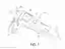 Fig. 02 - INTRAMEDULLARY NAIL TARGETING DEVICE