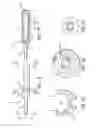 Fig. 06 - DISPOSABLE INTRAOCULAR LENS INSERTION SYSTEM