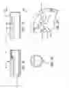 Fig. 08 - DISPOSABLE INTRAOCULAR LENS INSERTION SYSTEM