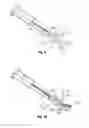 Fig. 07 - Meniscal repair device
