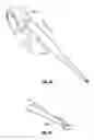 Fig. 65 - Meniscal repair device