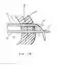 Fig. 87 - Meniscal repair device