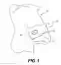 Fig. 02 - NASAL DEVICES INCLUDING DILATION AND USER COMMUNICATION AND METHODS OF USING SAME