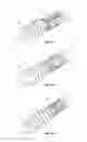 Fig. 56 - ATTACHMENT DEVICE AND METHODS OF USE