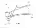 Fig. 82 - ATTACHMENT DEVICE AND METHODS OF USE