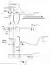 Fig. 02 - Optimization of pacemaker settings
