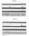 Fig. 06 - Methods and apparatus for treating anaphylaxis using electrical modulation