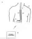 Fig. 01 - Global parameter adjustment for multiple stimulation programs