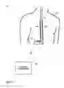 Fig. 02 - Global parameter adjustment for multiple stimulation programs