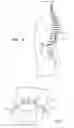 Fig. 06 - Short duration pre-pulsing to reduce stimulation-evoked  side-effects