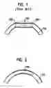 Fig. 02 - LONGITUDINALLY FLEXIBLE STENT