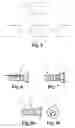 Fig. 04 - Stent and method for determining the position of a stent