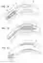 Fig. 02 - Endoprostheses