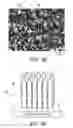 Fig. 04 - Endoprostheses