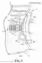 Fig. 04 - Glenoid implant anchor post