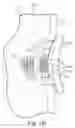 Fig. 09 - Glenoid implant anchor post
