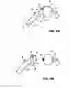 Fig. 06 - Hip socket with assembleable male ball shape having integrally formed ligament and female receiver and installation kit