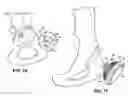Fig. 09 - Hip socket with assembleable male ball shape having integrally formed ligament and female receiver and installation kit