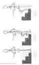 Fig. 02 - Control of a passive prosthetic knee joint with adjustable damping