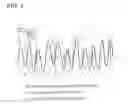 Fig. 04 - Ultrasonic wave propagation time measuring system