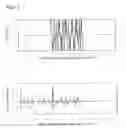 Fig. 08 - Ultrasonic wave propagation time measuring system