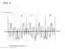 Fig. 09 - Ultrasonic wave propagation time measuring system
