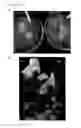 Fig. 07 - Stable, fertile, high polyhydroxyalkanoate producing plants and methods of producing them