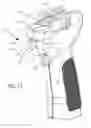 Fig. 14 - REMOVABLE FOREGRIP WITH LASER SIGHT