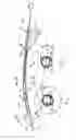 Fig. 02 - Jet ventilation catheter, in particular for ventilating a patient