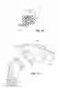 Fig. 33 - PATIENT INTERFACE SYSTEMS