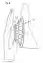 Fig. 03 - Pop-open respiratory etiquette device