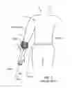Fig. 02 - Method and Apparatus for Multidirectional Positioning of a Shoulder