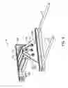 Fig. 13 - Method and Apparatus for Multidirectional Positioning of a Shoulder