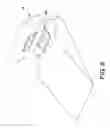 Fig. 09 - Apparatus and Method for Providing Proper Alignment of a Person's Airway
