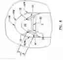 Fig. 05 - Pharyngeal wall treatment