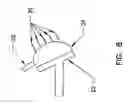 Fig. 07 - Pharyngeal wall treatment