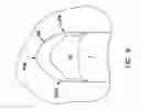 Fig. 08 - Pharyngeal wall treatment