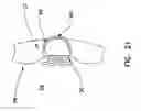 Fig. 20 - Pharyngeal wall treatment